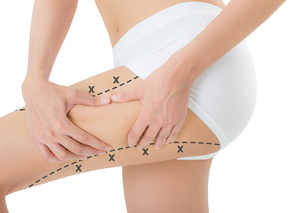 Alimenti e cellulite - Athena Centro Estetico